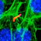 Illustration for article titled Radioactive Bacteria Can Kill Cancer